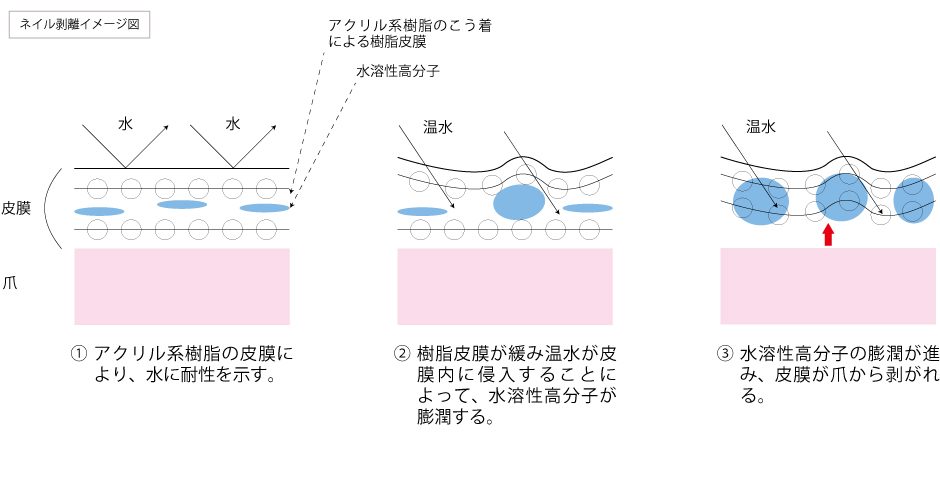 ネイル剥離イメージ図