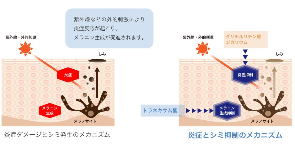 炎症によるシミ発生と美白・抗炎症による抑制のメカニズム比較図