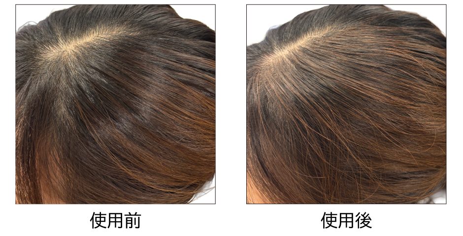 ヘアマスカラのカラーサンプル（ブラウン）。使用前後を比較し、生え際・分け目になじむ自然な仕上がりを示した画像