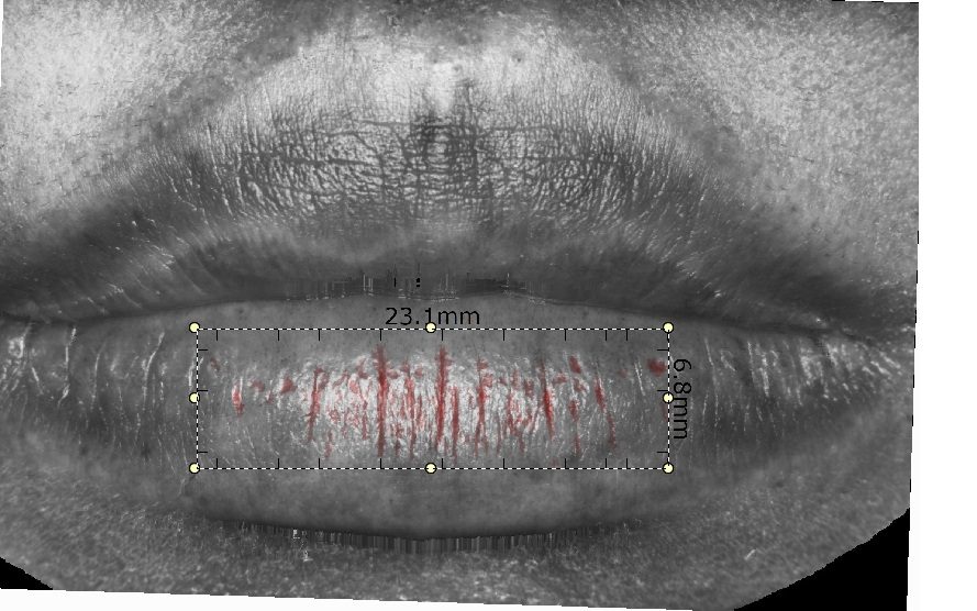 29日連用後の唇のシワ検出結果を示すPRIMOS解析画像